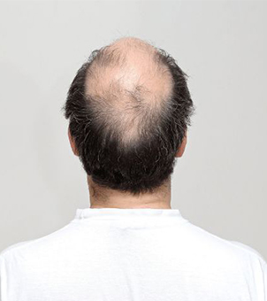 heat wrap for headers